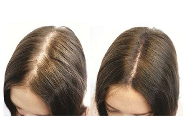 mọc tóc cùng sâm ngọc linh quảng nam